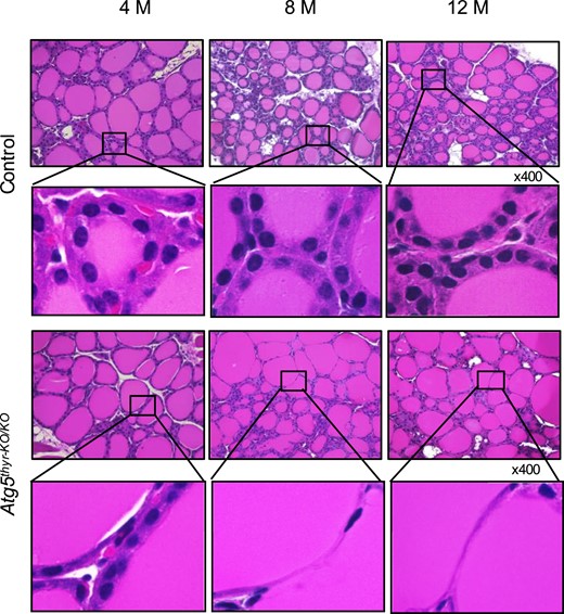 H&E staining of thyroid glands from 4-, 8-, and 12-month-old control and Atg5thyr-KO/KO mice. The thyroid glands removed in Fig. 2 (n = 3 or 4 for each group) were subjected to H&E staining as described in “Materials and Methods.” The magnified thyrocytes are shown in the insets. Because the histology was essentially the same between males and females, representative photos of male mice are shown. Original magnification, ×400. M, months.
