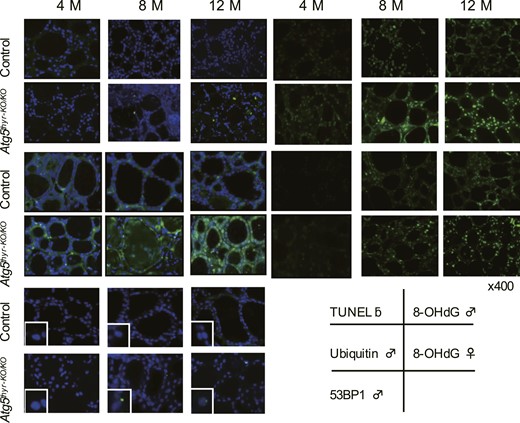 Immunohistochemical staining of TUNEL, ubiquitin, 8-OHdG, and 53BP1 in 4-, 8-, and 12-month-old control and Atg5thyr-KO/KO mice. The thyroid glands obtained in Fig. 2 (n = 3 or 4 for each group) were used for staining. Magnified 53BP1 foci are shown in the insets. Original magnification, ×400. Representative photos of male mice are shown for TUNEL, ubiquitin, and 53BP1 because different results between males and females were observed only in 8-OHdG. M, months.