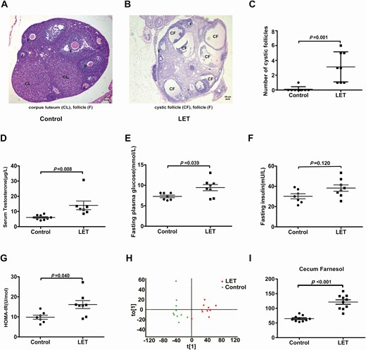 Insulin resistance and cecum farnesol are increased in PCOS model mice. Comparing the phenotype and cecal contents by global metabolomics between letrozole (LET)-induced PCOS model mice and controls (PCOS model mice: 8; controls: 9). (A, B) Hematoxylin and eosin staining of ovaries, corpus luteum (CL), cystic follicle (CF), and follicle (F). (C) Quantitative analysis of cystic follicles. (D) Serum testosterone levels. (E) Fasting blood glucose. (F) Fasting insulin. (G) HOMA-IR. (H) Orthogonal partial least squares-discriminate analysis (OPLS-DA) of cecum content global metabolomics. (I) Cecum farnesol. (C-I) P values were determined by 2-tailed Student t test, and P < 0.05 was considered statistically significant. HOMA-IR, homeostasis model assessment for insulin resistance index; PCOS, polycystic ovarian syndrome.