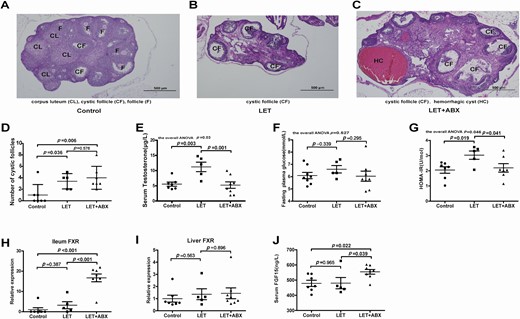 Removal of the intestinal flora can improve insulin resistance and suppress the development of PCOS. Phenotype analysis of PCOS model mice after antibiotic treatment (20 mg/mL vancomycin, 40 mg/mL neomycin sulfate, 40 mg/mL metronidazole, 40 mg/mL ampicillin intragastrically once daily) removed the intestinal flora for 35 days (control: 7; LET: 5; LET+ABX: 7). (A-C) Hematoxylin and eosin staining of the ovary, corpus luteum (CL), cystic follicle (CF), and hemorrhagic cyst (HC). (D) Quantitative analysis of cystic follicles. (E) Serum testosterone levels. (F) Fasting blood glucose. (G) HOMA-IR. (H) mRNA levels of ileum FXR. (I) mRNA levels of liver FXR. (J) Serum FGF15 levels. (D-J) P values were determined by 1-way ANOVA for normally distributed data and the Kruskal-Wallis test for nonnormally distributed data. P < 0.05 was considered statistically significant. ABX, antibiotic treatment; FGF15, fibroblast growth factor 15; FXR, farnesoid X receptor; HOMA-IR, homeostasis model assessment for insulin resistance index; LET, letrozole; PCOS, polycystic ovarian syndrome.