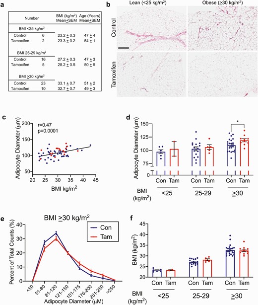 Tamoxifen treatment associates with larger adipocytes in women with BMI > 30 kg/m2. (A) descriptive data for women with and without tamoxifen treatment. (B) representative breast adipose images from 1 subject each, control or tamoxifen-treated, BMI < 25 kg/m2 or > 30 kg/m2. Scale bar is 400 μm. (C) spearman correlation of subject BMI and average adipocyte diameter. Red circles are from tamoxifen-treated women, blue circles are controls. (D) average adipocyte diameters from control or tamoxifen treated women with BMI < 25 kg/m2 (Con n = 6, Tam n = 2), 25-29 kg/m2 (Con n = 16, Tam n = 5), or > 30 kg/m2 (Con n = 22, Tam n = 10). P < .05 by unpaired t-test. (E) Adipocyte diameter represented as the proportion of each cell size representative to total cell count in women with BMI > 30 kg/m2. Note the frequency of larger adipocytes in tamoxifen-treated women. Con n = 22, Tam n = 10. (F) Individual BMI in each category from control or tamoxifen-treated women with BMI < 25 kg/m2 (Con n = 6, Tam n = 2), 25-29 kg/m2 (Con n = 16, Tam n = 5), or > 30 kg/m2 (Con n = 22, Tam n = 10).
