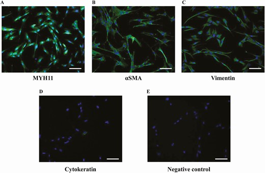 Characterization of hSMCs isolated from human vagina. (A, B, C, D) Representative images of hSMCs immunostaining for specific smooth muscle markers MYH11, αSMA, and vimentin, and for the epithelial marker cytokeratin (taken as a negative control), respectively. (E) A representative image of the negative control obtained omitting the primary antibodies. The quantitative analysis was performed by counting positive cells in at least 10 fields per slide of 3 different cell preparations obtained from three patients (scale bar = 100 µm).