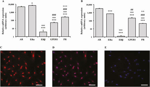 Relative mRNA expression of sex steroid receptors in human distal vaginal tissues and cells. (A, B) The relative mRNA expression of sex steroid receptors AR, ERα, ERβ, GPER1, and PR in human vaginal tissues derived from laparoscopic biopsies (n = 10) and in smooth muscle cells (hSMCs) isolated from the corresponding vaginal samples (n = 4, performed in triplicate), respectively. Data were calculated according to the 2–ΔΔCt comparative method, using ribosomal subunit 18S as the housekeeping gene for normalization. Results are expressed as arbitrary units, calculated as fold increase vs the lower mRNA expression value in the experiment, and are reported as mean ± SEM. *P < .05, ***P < .001 vs AR; °°°P < .001 vs ERα; ##P < .01, ###P < .001 vs ERβ; ++P < .01, +++ P < .001 vs GPER1. (C, D) Two representative images of nuclear immunostaining for AR receptor and the corresponding nuclear DAPI double labeling, respectively. (E) A representative image of the negative control obtained omitting the primary antibodies. At least 3 preparations obtained from 3 different patients were evaluated (scale bar = 100 µm).