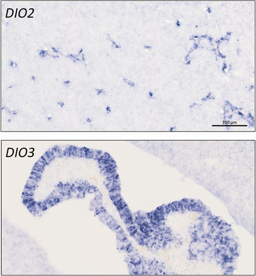 Expression of deiodinases at the brain barriers in 8-day-old chicken embryos. In situ hybridization shows DIO2 expression in the developing capillaries of the blood-brain barrier while DIO3 is highly expressed in the developing choroid plexus at the blood-cerebrospinal fluid barrier. Scale bar 100 µm for both pictures.