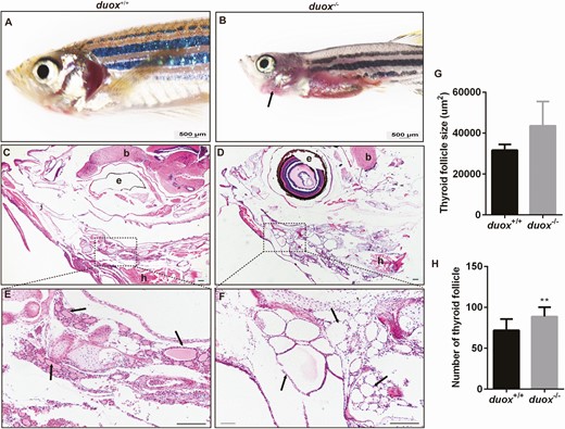 Thyroid morphology in duox mutant and wildtype zebrafish. (A,B) Adult mutant zebrafish exhibited a visible external goiter-like growths (arrows), while wildtype did not. (C-F) Hematoxylin and eosin stain in horizontal sectioning of thyroid follicles (arrows). (G-H0 Quantification of the size of thyroid follicles and the number of thyroid follicles (n = 5, respectively). The size of thyroid follicles was larger and the number of thyroid follicles were more in KO mutants than WT, which showed hyperplastic thyroid follicle in mutant line. e, eye; b, brain; h, heart. scale bars: 500 μm for A-B, 200 μm for C-F; **P < .01.