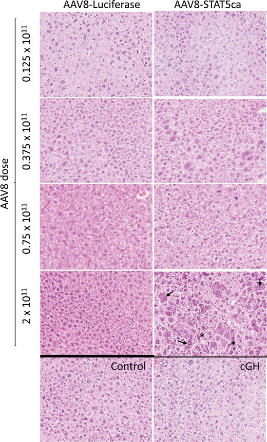 H&E staining of AAV8-STAT5CA-infected liver. Liver sections from male mice treated with AAV8-STAT5CA or AAV8-Luciferase at the indicated GC dose per mouse, as in Fig. 2B, were stained with H&E. Images reveal a STAT5CA dose-dependent histopathology, which was evident and most consistent at the highest dose of AAV8 dose (2 × 1011 GC), with hepatocyte hyperplasia, increased numbers of multinuclear hepatocytes (arrows), karyomegaly, and apoptosis (asterisks). Also see Fig. S2 (42). No histopathology was evident in mice given cGH infusion for 17 days. Images collected with an Olympus FSX-100 instrument at 16×. H&E, hematoxylin and eosin.