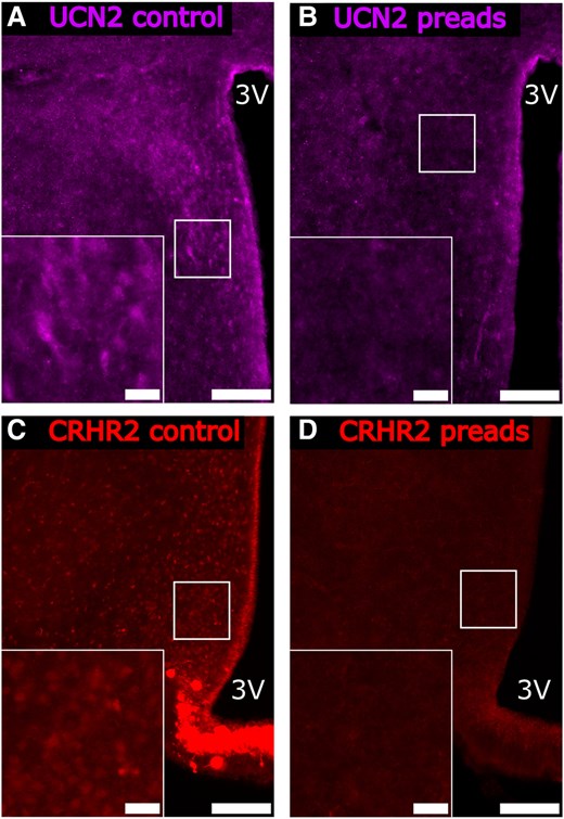 Representative photomicrographs of preadsorption control experiments for the (A and B) anti-UCN2 and (C and D) anti-CRHR2 antibodies. Antiserum samples were incubated for 24 hours with (A and C) phosphate-buffered saline or with (B and D) the corresponding control peptide according to manufacturer's suggestions at 4°C, before proceeding with immunostaining. Main panel scale bar: 50 µm, Inset panel scale bar: 10 µm, 3 V, third ventricle.
