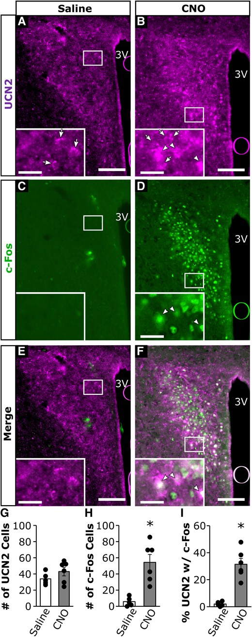Representative photomicrographs of UCN2 and c-Fos cells from OVX DBH-cre mice administered a stimulatory DREADD virus into the NTS, followed 2 weeks later by treatment with (A, C, and E) intraperitoneal (i.p.) saline; or (B, D, and F) 1 mg/kg CNO. Panels illustrate immunostaining for (A and B) UCN2; (C and D) c-Fos; or (E and F) merged images in fixed neural tissue collected 2 hours following saline or CNO. Arrows denote single-labeled UCN2 cells. Arrowheads denote dual-labeled UCN2 cells with c-Fos. White box indicates location of zoomed panels. Main panels scale bar: 50 µm, inset panels: 10 µm, 3 V, third ventricle. Bar graphs represent average values across hemisections per animal (mean ± SEM, n = 5-6/group) for (G) number of PVN UCN2 cells; (H) number of PVN c-Fos cells; and (I) percentage of PVN UCN2 cells that contain c-Fos. *P less than .05.