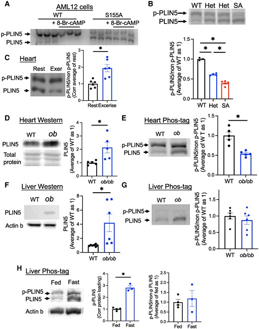 Phos-tag gel allows the detection of p-PLIN5. (A) Cell lysate from AML12 cell overexpressing wild type (WT) or S155A PLIN5 and treated with or without 8-Br-cAMP was run on Phos-tag gel and immunoblotted by anti-PLIN5 antibody. Representative image of 3 experiments. (B) Phos-tag gel of the liver from fasted 1-year-old male WT, SA het (het) and SA/SA (SA) mice assessed the ratio of phosphorylated (p-PLIN5) and nonphosphorylated (non-p-PLIN5). n = 3-5. (C) Phos-tag gel assessed p-PLIN5 and non-p-PLIN5 in the heart of WT mice with (Exer) and without (Rest) treadmill exercise. n = 6. (D-G) The heart (D, E) and the liver (F, G) lysates from female WT and ob/ob mice were analyzed for PLIN5 by regular Western blot (D, F) and Phos-tag gel (E, G), n = 5-7. Western blot of PLIN5 was normalized by total protein staining for the heart (D) and actin b for the liver (F). (H) Phos-tag gel assessed the abundance of p-PLIN5 and non-p-PLIN5 in the total liver lysate of fed or overnight fasted male mice. n = 3-4. (B-H) Representative gels and densitometry data are shown. Data are mean ± SEM. (B) *P < .05 by 1-way ANOVA with the Sidak multiple comparison test. (C-H) *P < .05 by the Student t test.