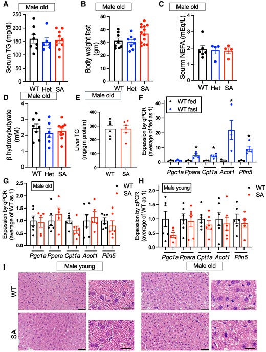 Serum chemistry and hepatic lipid metabolism gene expression in fasted PLIN5 SA/SA male mice. (A) Body weight, (B) serum TG, (C) serum nonesterified fatty acids (NEFAs), and (D) serum β-hydroxybutyrate of 1-year-old male mice (male old) after overnight fasting. Each dot represents 1 mouse. n = 6-8 (WT), 4-8 (het), and 4-13 (SA). (E) TG contents in the liver corrected for liver protein (n = 6). (F-H) qPCR compared the expression of genes in lipid metabolism in the liver of (E) WT mice fasted overnight (n = 3) vs fed ad libitum (n = 4), (F) 1-year-old WT (n = 6) vs SA mice fasted overnight (n = 5-6), and (H) 3-month-old WT (n = 6) vs SA male mice (male young) fasted overnight (n = 5-6). (I) Representative hematoxylin and eosin staining of the liver after overnight fast for old and young WT and SA male mice. Low magnification on the left (scale bar, 50 μm) and high magnification on the right (scale bar, 20 μm). Data are mean ± SEM. *P < .05 by the Student t test.