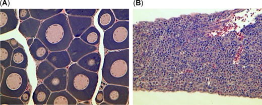 Gonadal tissue from treadfin shad showing (A) immature oogonia and (B) immature spermatogonia.