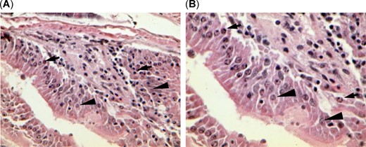 The gastrointestinal tract of threadfin shad, Dorosoma petenense, from bloom site Brannon Island also showed severe epithelial cell necrosis (karyopyknosis and karyorrhexis) at (A) ×400 and (B) ×600, indicating potential exposure to toxin. Arrows point to karyopyknosis and karyorrhexis, and arrowheads point to normal enterocytes.