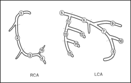 Figure 1 Segmental anatomy of the coronary arteries after a modified AHA classification. 1, RCA proximal; 2, RCA mid; 3, RCA distal; 4, right posterior descendens; 5, main stem; 6, LAD proximal; 7, LAD mid; 8, LAD distal; 9, first diagonal; 10, second diagonal; 11, LXC proximal; 12, obtuse marginal; 13, LCX distal; 14, LCX posterolateral branch; 15, LCX posterodescendens branch; 16, RCA posterolateral branch. RCA, right coronary artery; LCX, left circumflex artery; LAD, left anterior descending coronary artery.