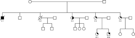 Figure 1 Phenotypic heterogeneity in LVNC. Family pedigree NC3 showing phenotypic heterogeneity, with isolated DCM, isolated LVNC and LVE co-existing within the same family. The family was screened after the death of a proband (II : 1) with DCM, who died 3 years after a cardiac transplant for end-stage heart failure. His explanted heart showed DCM and on review had no evidence of LVNC or excessive trabeculations of the left ventricle. A sister (II : 2) died of cardiac failure immediately post-partum. Another sister (II : 3) had a mildly dilated left ventricle, and systolic function at the lower limit of normal (FS=26%). A further sister (II : 4) had a history of syncope, isolated left ventricular enlargement, a thickened posterior wall, preserved systolic function, frequent runs of non-sustained ventricular tachycardia on cardiac monitoring, and received a prophylactic ICD. Another sister (II : 5), her daughter (III : 1), and son (III : 2), have extensive LVNC and normal systolic function. Solid square and circle symbols indicate affected males and females with DCM, respectively; open symbols, unaffected; half-symbols, left ventricular enlargement; quarter symbols, LVNC; and slashes, death.