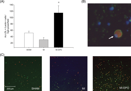 Effects of erythropoietin treatment on number of circulating endothelial progenitor cells. (A) Graphic representation of number of endothelial progenitor cells. (B) Endothelial progenitor cell under high magnification (white arrow), positively stained for DiI AcLDL (red cytoplasm) and lectin (green cytoplasm), including DAPI nuclear staining (blue). (C) Representative microscopic fields from all experimental groups, with double stained (green + red) positive endothelial progenitor cells. *P < 0.01 vs. myocardial infarction.