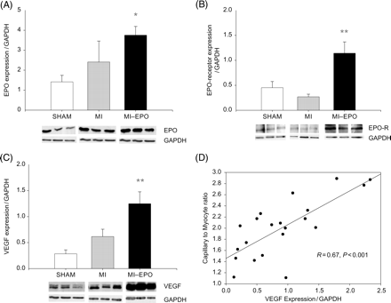 Expression of erythropoietin, erythropoietin-receptor, and vascular endothelial growth factor in the left ventricular free wall. (A) Bar graph and representative bands showing the difference in the expression of erythropoietin in the left ventricular free wall. (B) Bar graph and representative bands showing the difference in the expression of erythropoietin-receptor in the left ventricular free wall. (C) Bar graph and representative bands showing the difference in the expression of VEGF in the left ventricular free wall. (D) Scatter plot delineating the relation between capillary-to-myocyte ratio and VEGF expression in the left ventricular free wall of all groups (sham, myocardial infarction, and myocardial-infarction–erythropoietin). EPOR, erythropoietin-receptor; VEGF; vascular endothelial growth factor. *P < 0.05 vs. myocardial infarction, **P < 0.01 vs. myocardial infarction.