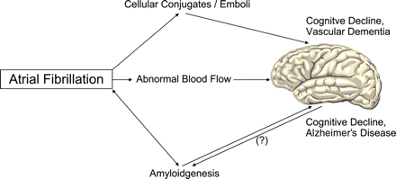 Association between atrial fibrillation (AF), cognitive decline, and dementia. AF increases the occurrence of circulating cellular conjugates (e.g. leukocyte–platelet conjugates) and the development of atrial thrombi. Cerebral embolization of the factors impairs cognitive function. In addition, AF induces alterations in cerebral blood flow, which may lead to cerebral hypoperfusion. AF has been described as a risk factor for the occurrence of Alzheimer's disease. Amyloid fibrils occur in Alzheimer's disease as well as in subgroups of patients with AF, although the fibril proteins are different. So far it is unknown if both diseases share a common pathophysiological basis with regard to amyloidgenesis.