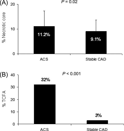  Amount of necrotic core and prevalence of thin cap fibroatheroma (TCFA) in plaques of patients presenting with acute coronary syndromes (ACS) and with stable coronary artery disease (CAD). ( A ) A larger amount of necrotic core was observed in plaques of patients with ACS as compared with patients with stable CAD. ( B ) TCFA were more frequently observed in plaques of patients with ACS as compared with patients with stable CAD. 