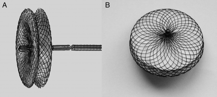 (A) Lateral view of the Shanghai symmetrical perimembranous ventricular septal defect occluder; (B) front view of the Shanghai symmetrical perimembranous ventricular septal defect occluder.