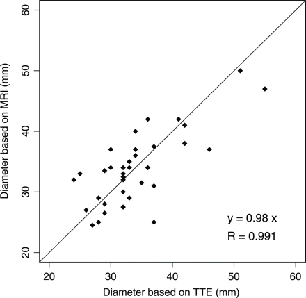 Magnetic resonance imaging (MRI) and transthoracic echocardiography (TTE) measurements of aortic diameter at the sinus of Valsalva for 36 patients with Fabry disease. The student t-test value (P-value = 0.814) confirms that TTE and MRI results are comparable.