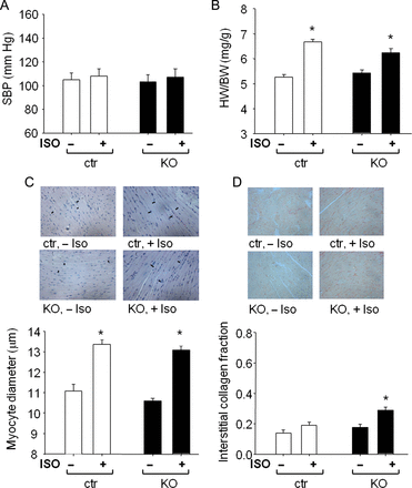 Cardiac remodelling induced by isoproterenol infusion in control mice and mice with cardiomyocyte-restricted deletion of cGMP-dependent protein kinase I. (A) systolic blood pressure (SBP), (B) heart weight (HW) to body weight (BW) ratios, (C) LV myocyte diameters, and (D) LV interstitial collagen fractions of control mice and mice with cardiomyocyte-restricted deletion of cGMP-dependent protein kinase I (n = 8 per group); *P < 0.05 vs. vehicle.