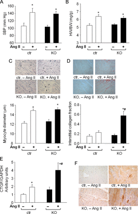 Cardiac remodelling induced by Ang II infusion in control mice and mice with cardiomyocyte-restricted deletion of cGMP-dependent protein kinase I. (A) systolic blood pressure (SBP), (B) heart weight (HW) to body weight (BW) ratios, (C) LV myocyte diameters, (D) LV interstitial collagen fractions of control mice and mice with cardiomyocyte-restricted deletion of cGMP-dependent protein kinase I (n = 16 per group); and (E and F) real time RT–PCR and immunohistochemical analyses of left ventricular CTGF expression (F: representative pictures; original magnification ×400) (n = 8 per group); P < 0.05 *vs. vehicle, #vs. control.