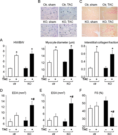 Cardiac remodelling and function in control and cardiomyocyte cGMP-dependent protein kinase I KO mice after TAC or sham operation. (A) Heart weight (HW) to body weight (BW) ratios, (B) LV myocyte diameters, (C) LV interstitial collagen fractions of control mice and mice with cardiomyocyte-restricted deletion of cGMP-dependent protein kinase I. (D) LV end-diastolic area (EDA), (E) end-systolic area (ESA), and (F) fractional shortening percentage (FS%) from control and cardiomyocyte cGMP-dependent protein kinase I KO mice after TAC or sham operation, measured by echocardiography (n = 10 per group); *P < 0.05 vs. sham, #P < 0.05 vs. control.