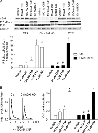 Effect of CNP on Ser16-phosphorylation of phospholamban and Ca2+-transients of isolated myocytes. (A) Effects of CNP (10 nM–1 μM) and isoproterenol (10 nM, all 15 min) on phospholamban phosphorylation at Ser16 in control and cGMP-dependent protein kinase I-deficient myocytes. (Top) Western blots showing the expression of cGMP-dependent protein kinase I, P-PLBSer16, total phospholamban as well as GAPDH in isolated myocytes. (Bottom) Levels of P-phospholamban were normalized to total phospholamban. Ratios were calculated as x-fold respective vehicle-treated control myocytes. (B, left) Representatives examples of effects of CNP (0.1 μM) on Ca2+ transients in control and cGMP-dependent protein kinase I-deficient myocytes. Panels show respective single traces before (basal) and during CNP treatment. (Right) On average, the peak amplitude of Ca2+-transients (Indo-1 ratio, 405/495 nm, systolic–diastolic) was not different in cGMP-dependent protein kinase I-deficient compared with control myocytes. Superfusion with CNP (10 and 100 nM, 5 min) increased Ca2+ transients in control myocytes. These effects were abolished in cGMP-dependent protein kinase I-deficient cells (n = 8); *P < 0.05 *vs. vehicle, #vs. control.