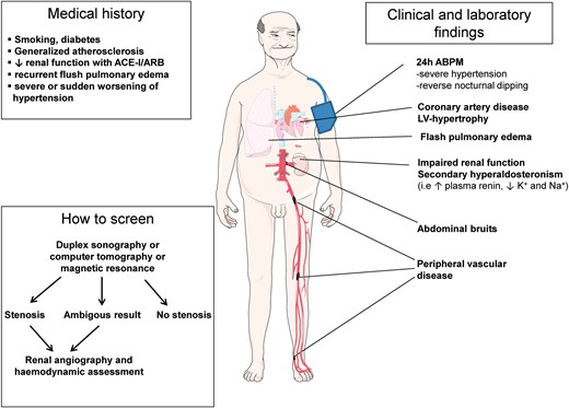 Medical history, clinical findings, and screening work-up in patients with suspected atherosclerotic renal artery stenosis. ACE-I, angiotensin-converting enzyme inhibitor; ARB, angiotensin-receptor blocker; 24 h-ABPM, 24 h ambulatory blood-pressure monitoring; K+, potassium; Na+, sodium.