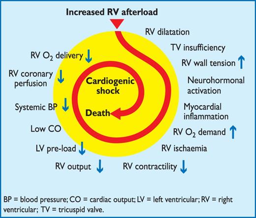 Key factors contributing to haemodynamic collapse in acute pulmonary embolism