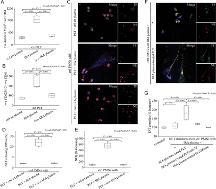 The microenvironment in infarct-related coronary artery activates platelets for subsequent neutrophil extracellular trap generation in polymorphonuclear neutrophils. Fluorescence-activated cell-sorting analysis of Annexin V (A) and CD62P (B) on control platelets treated with plasma obtained by selective coronary sampling. (C), (D), (E) Neutrophil extracellular trap formation by control polymorphonuclear neutrophils incubated with control platelets pre-treated with plasma obtained by selective coronary sampling. (C), (D) Confocal microscopy and (E) myeloperoxidase–deoxyribonucleic acid complex on neutrophil extracellular trap structures. (F) Neutrophil extracellular trap generation after stimulation of control polymorphonuclear neutrophils with plasma from infarct-related coronary artery of ST-segment elevation acute myocardial infarction patients and control platelets pre-treated with infarct-related coronary artery plasma (confocal microscopy). (G) Thrombin levels in control plasma incubated with isolated neutrophil extracellular trap structures from control polymorphonuclear neutrophils stimulated as in (F). Anti-tissue factor antibody was used to neutralize tissue factor-mediated thrombin generation. DNase I was used for neutrophil extracellular trap scaffold degradation. (C) and (F) Green: tissue factor; red: NE; blue: 4′,6-diamidino-2-phenylindole/deoxyribonucleic acid. One representative out of four independent experiments is shown. Original magnification: ×600. Scale bar: 5 μm. For (A), (B), (D), (E), (G) n = 4.