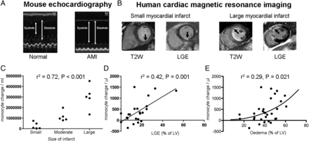 The extent of the monocyte response correlates with the extent of myocardial injury. (A) Transthoracic echocardiography of mouse hearts following acute myocardial infarction (n = 6/group). (B) Cardiac magnetic resonance imaging to quantify area of injury (T2-weighted sequence) and infarction (LGE sequence) in humans (n = 30 acute timepoint, n = 23 follow up). (C) In mice, the total peripheral monocyte count was highly correlated with size of infarct (r2 = 0.72, P < 0.001). (D) In humans, the magnitude of the monocyte response for each patient following acute myocardial infarction correlated with the extent of irreversible myocardial injury determined by LGE at 6 months (r2 = 0.42, P = 0.001) and weakly (non-linear relationship) with the area of risk, as measured by oedema (r2 = 0.29, P = 0.021, E).