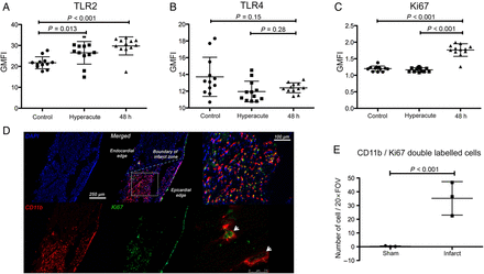 Inflammatory and mitosis pathways are up-regulated in circulating monocytes en route to inflamed myocardium. (A) Flow cytometry of peripheral circulating monocytes 48 h following acute myocardial infarction in humans identified a significant increase in the expression of TLR2 (P < 0.001) but not TLR4 (P = 0.14, B) (n = 12/group). (C) Ki67 expression was significantly up-regulated in monocytes at 48 h following injury but not hyperacutely (at presentation) in comparison with controls (P < 0.001) (n = 12/group). (D and E) Immunohistochemistry of mouse hearts (blue: DAPI, red: CD11b, green Ki67) following acute myocardial infarction confirmed a significant increase in the number of leukocytes expressing Ki67 (white arrows) (P < 0.001) indicating up-regulation of mitosis pathways in infarcted myocardium (n = 3/group). Data are represented by mean ± standard deviation.