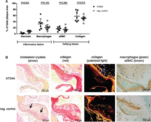 AT04A immunization reduces necrotic content and cholesterol crystals in plaques. Necrotic and macrophage content as unstable factors, and αSMCs and collagen as stable factors, were determined in the severe (type IV–V) lesions, and expressed as percentage of total plaque area. 10 mice in the control and 7 in vaccine group had severe lesions and were included in this analysis (A). Representative images of HPS staining, Sirius red staining for collagen, collagen expression under polarized light and double immunostaining with α-actin for SMCs (brown) and MAC-3 for macrophages (green) (B). The arrows depict necrotic areas, including cholesterol clefts. A Mann–Whitney U test was used for statistical analysis. Data are presented as group means ± SD (n = 7–10).