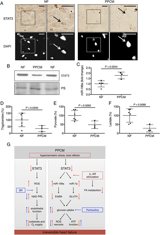 Analyses in left ventricular tissue from peripartum cardiomyopathy patients and non-failing controls. (A) Immunohistochemistry (B) and western blot depicting STAT3 protein levels, (C) miR-199a expression, (D) triglycerides, (E) pyruvate, and (F) lactate content in LV tissue of peripartum cardiomyopathy hearts (n = 3) and LV tissue from non-failing hearts (n = 5–7). (G) Scheme depicting role of STAT3-dependent signalling networks for adverse effects by β1-adrenergic receptor stimulation in peripartum cardiomyopathy. Data are mean ± SD. P-values were computed by two-tailed Student's t-test.