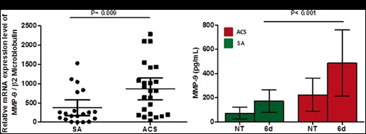 Matrix metalloproteinase-9 expression in CD4+ T-cells at baseline and after T-cell receptor stimulation. (A) Matrix metalloproteinase-9 mRNA expression was assessed by quantitative real-time polymerase chain reaction in CD4+ T-cells (20 stable angina patients and 24 acute coronary syndrome patients were included). Data are presented as single data points, mean 95% CI. (B) Matrix metalloproteinase-9 protein levels were assessed by ELISA in the supernatants of CD4+ T-cells at baseline and after 6 days of T-cell receptor stimulation (five patients for each group of study). Data are presented as mean 95% CI. Green histograms: stable angina; Red histograms: acute coronary syndrome. MFI, median fluorescence intensity; NT, untreated.