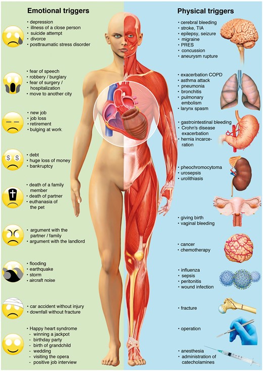 Emotional and physical stress factors precipitating takotsubo syndrome. Reprinted, modified, and translated with permission from Schlossbauer et al. 7 COPD, chronic obstructive pulmonary disease; PRES, posterior reversible encephalopathy syndrome; TIA, transient ischaemic attack.