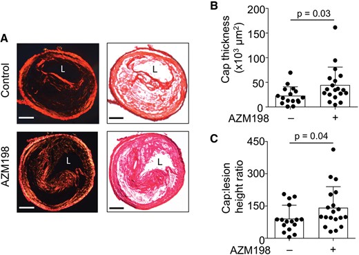 Pharmacological inhibition of myeloperoxidase (MPO) increases fibrous cap thickness in unstable plaque. (A) Representative picrosirius red stained sections of unstable plaque viewed under polarised light (left) and bright field (right) in TS Apoe−  /  − mice fed WD ± AZM198 for 13 weeks. Scale bar = 100 μm. L, lumen. (B) Fibrous cap thickness and (C) cap: lesion height ratio in TS mice fed WD ± AZM198. Quantitative data show individual data with mean + standard deviation analysed by Mann–Whitney rank sum test.