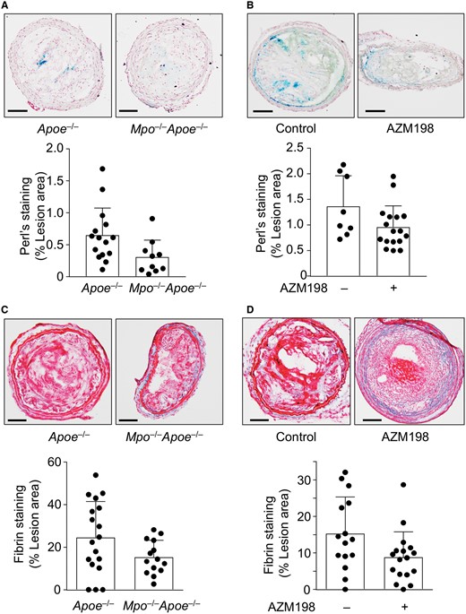 Effect of AZM198 on intraplaque fibrin and haemosiderin. Unstable plaque was assessed by Perl’s Prussian Blue and Martius Scarlet Blue (MSB) staining in TS Mpo−  /  −Apoe−  /  − and TS Apoe−  /  − mice ± AZM198 to detect haemosiderin and fibrin, respectively. (A and B) Representative images of Perl’s staining and quantification of haemosiderin+ area expressed as percentage per total lesion area. (C and D) Representative images of lesion fibrin (bright red stain) by MSB staining with quantification showing percentage fibrin+ area per total lesion area. Quantitative data show individual data with mean + standard deviation analysed by Mann–Whitney rank sum test (A, B, D) and unpaired t-test (C). Scale bar = 100 μm.