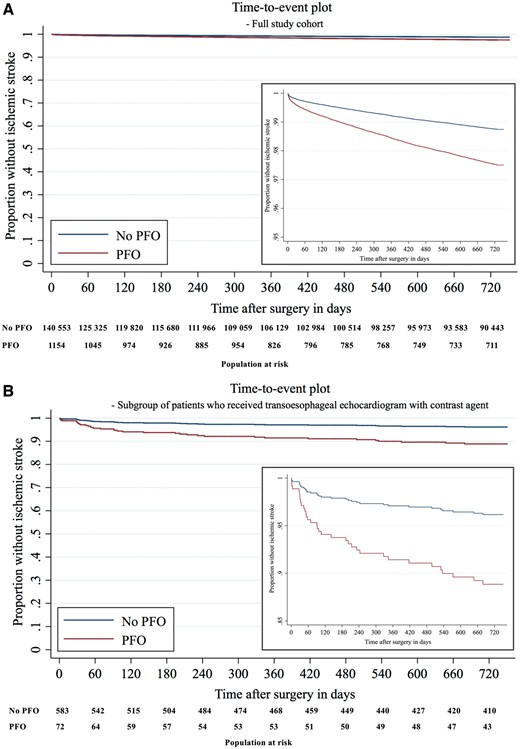 Time-to-event plot. (A) Time-to-event plot in full study cohort. (B) Time-to-event plot in subgroup of 658 patients who received transoesophageal echocardiogram with contrast agent. Time-to-event plots show survivor function for patients with PFO (red) and without PFO (blue). It was estimated after multivariable Cox regression analysis for ischaemic stroke within 2 years after surgery, censoring patients at time of death or when they were lost to follow up. The population at risk with and without PFO is shown in 60-day intervals.