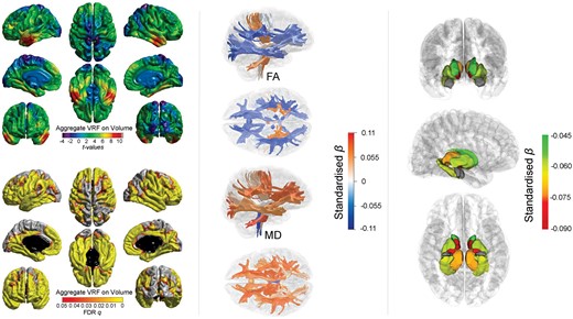Associations between aggregate vascular risk and cortical volume (left panel), white matter tract-specific microstructure (centre panel showing right lateral and superior views), and subcortical volume (right panel showing, from top to bottom: anterior, lateral, and inferior views). Higher aggregate vascular risk is associated with significantly lower cortical volume, lower fractional anisotropy and higher mean diffusivity in the majority of white matter fibres, and lower subcortical volume, except for the amygdala (grey).