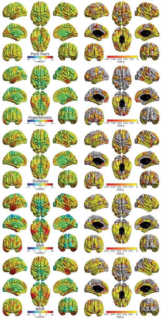 Significant associations (left: t-maps and right: FDR-corrected q-values) between cortical volume and vascular risk factors (modelled individually, alongside age, sex, ethnicity, head size, and scanner head position confounds). See Supplementary material online, Figure S3 for non-significant associations for pulse pressure and hypercholesterolaemia. T-maps are scaled with the same limits to aid comparison of relative effect size across risk factors.