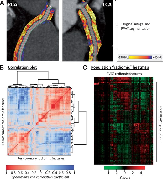 Radiomic phenotyping of coronary perivascular adipose tissue. (A) The perivascular adipose tissue of the right and left coronary arteries (left main and proximal to mid left anterior descending artery) was segmented and used to calculate a number of shape-, attenuation-, and texture-related statistics. (B) Correlation plot of all 1391 stable radiomic features in the SCOT-HEART population (n = 1575 patients), with hierarchical clustering revealing distinct clusters of radiomic variance. (C) Heatmap of scaled radiomic features in the SCOT-HEART population revealing between-patient variance across the cohort. LCA, left coronary artery; PVAT, perivascular adipose tissue; RCA, right coronary artery.