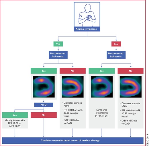 Decision tree for patients undergoing invasive coronary angiography. Decisions for revascularization by percutaneous coronary intervention or coronary artery bypass grafting are based on clinical presentation (symptoms present or absent), and prior documentation of ischaemia (present or absent). In the absence of prior documentation of ischaemia, indications for revascularization depend on invasive evaluation of stenosis severity or prognostic indications. Patients with no symptoms and ischaemia include candidates for transcatheter aortic valve implantation, valve, and other surgery. CAD = coronary artery disease; FFR = fractional flow reserve; iwFR = instantaneous wave-free ratio; LV = left ventricle; LVEF = left ventricular ejection fraction; MVD = multivessel disease.