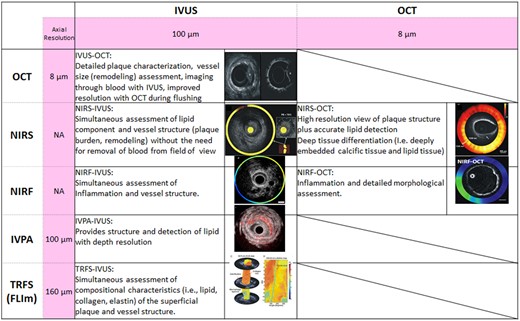 Summary of potential advantages of hybrid catheters. FLIm, fluorescence lifetime imaging; IVPA, intravascular photoacoustics; IVUS, intravascular ultrasound; NA, not available; NIRF, near-infrared fluorescence; NIRS, near-infrared spectroscopy; OCT, optical coherence tomography; TRFS; time-resolved fluorescence spectroscopy.