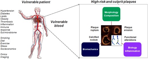 High-risk and culprit plaques in ‘vulnerable patients’. The combination of ‘vulnerable patient’ phenotype and ‘high-risk plaque’ is likely required to produce an adverse cardiac event. Plaque rupture, plaque erosion, calcified nodule and functional coronary alterations represent pathophysiological mechanisms underlying acute coronary syndromes. Photography adapted from Partida et al. 6 and Gijsen et al. 7 (Creative Commons Licence CC-BY-NC).
