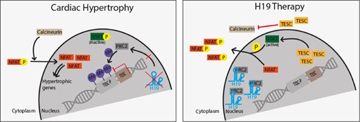 H19 gene therapy blocks PRC2-mediated methylation of the Tescalcin promoter and disrupts NFAT signaling which subsequently prevents and reverses cardiac hypertrophy-mediated heart failure.