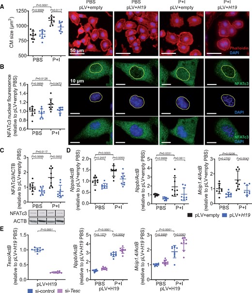 Lentiviral overexpression of H19 blocks cardiac hypertrophy in vitro. (A) Size of H19 overexpressing (pLV+H19) cardiomyocytes after hypertrophic stimulation (48 h; DAPI, 4′,6-diamidino-2-phenylindole; I, isoproterenol; Phalloidin, Phalloidin–Tetramethylrhodamine B isothiocyanate; P, phenylephrine). (B) Immunohistochemical analysis of NFATc3 localization. (C) Immunoblotting of NFATc3 in cell lysates. (D) Expression levels of cardiac stress markers Nppa (natriuretic peptide A), Nppb (natriuretic peptide B), and Mcip1.4 (myocyte-enriched calcineurin-interacting protein 1.4; n = 3 independent experiments). (E) Validation of Tesc-specific siRNA (si-Tesc) and expression levels of Nppb and Mcip1.4 in H19-overexpressing cells (pLV+H19) after hypertrophic stimulation in presence and absence of Tesc (P + I, 48 h). Data are means ± SD. P-values were determined by one-way ANOVA with Bonferroni correction.