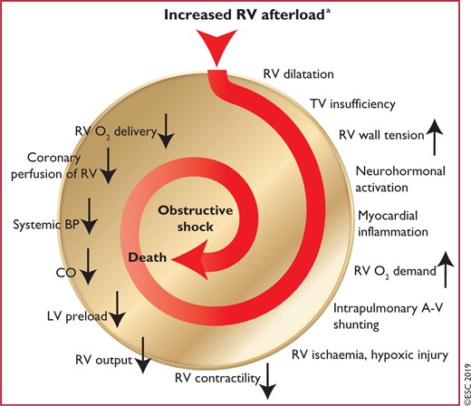 Key factors contributing to haemodynamic collapse and death in acute pulmonary embolism (modified from Konstantinides et al.65 with permission). A-V = arterio-venous; BP = blood pressure; CO = cardiac output; LV - left ventricular; O2 = oxygen; RV = right ventricular; TV = tricuspid valve. aThe exact sequence of events following the increase in RV afterload is not fully understood.