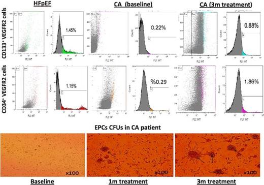 EPCs in CA patients and during therapy